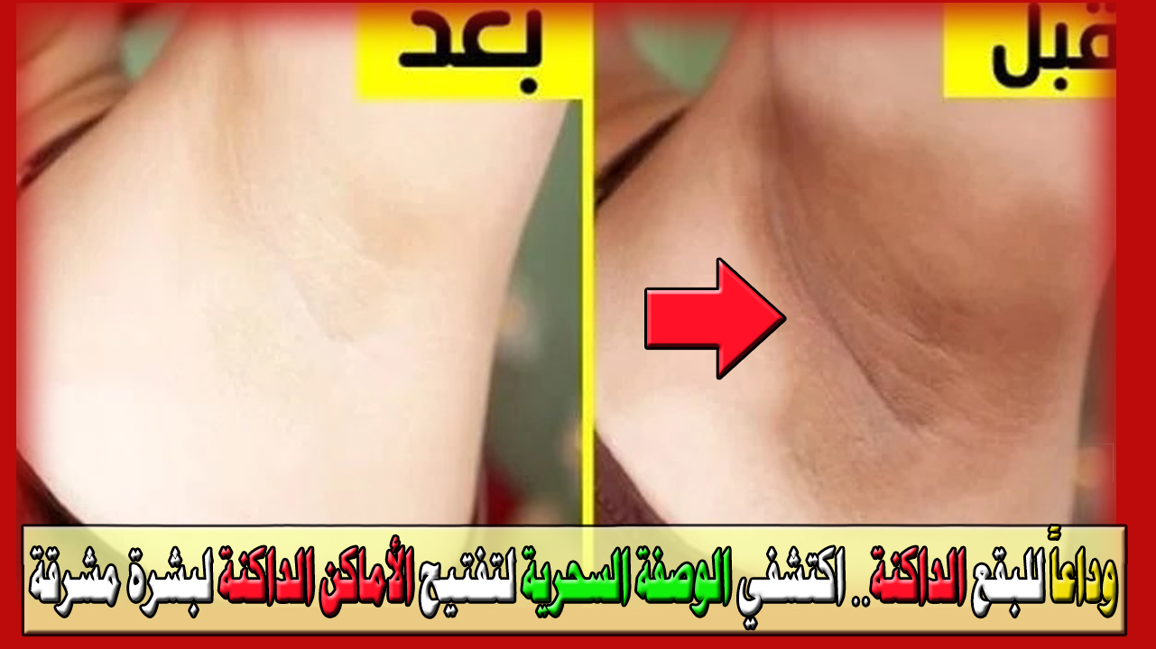 الوصفة السحرية لتفتيح الأماكن الداكنة