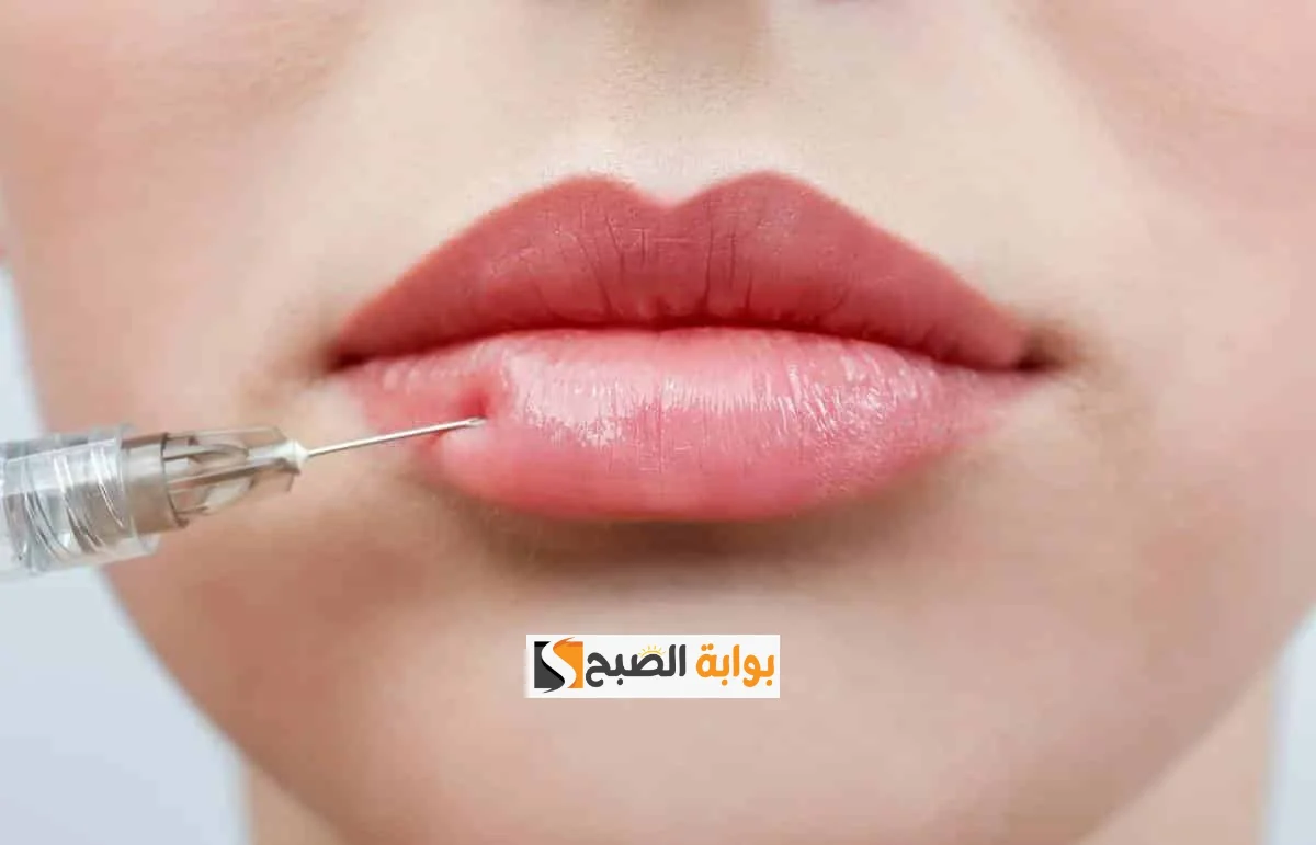 فيلر الشفايف