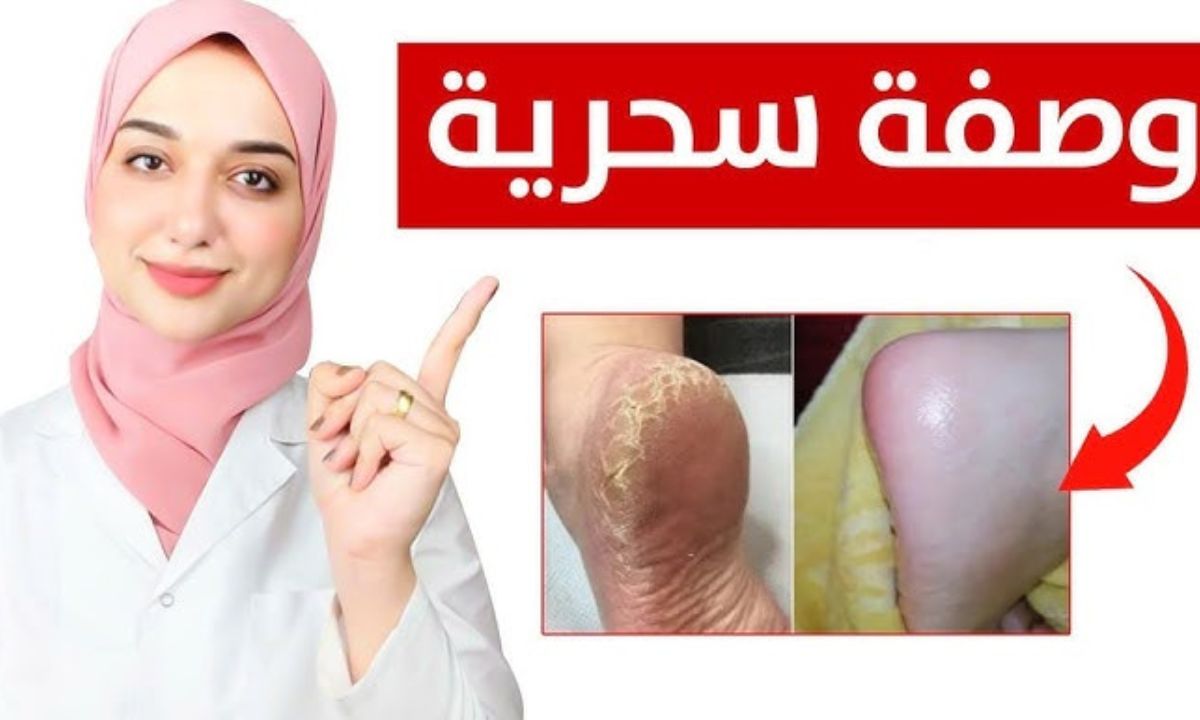 ماسك لتنعيم القدمين واليدين 