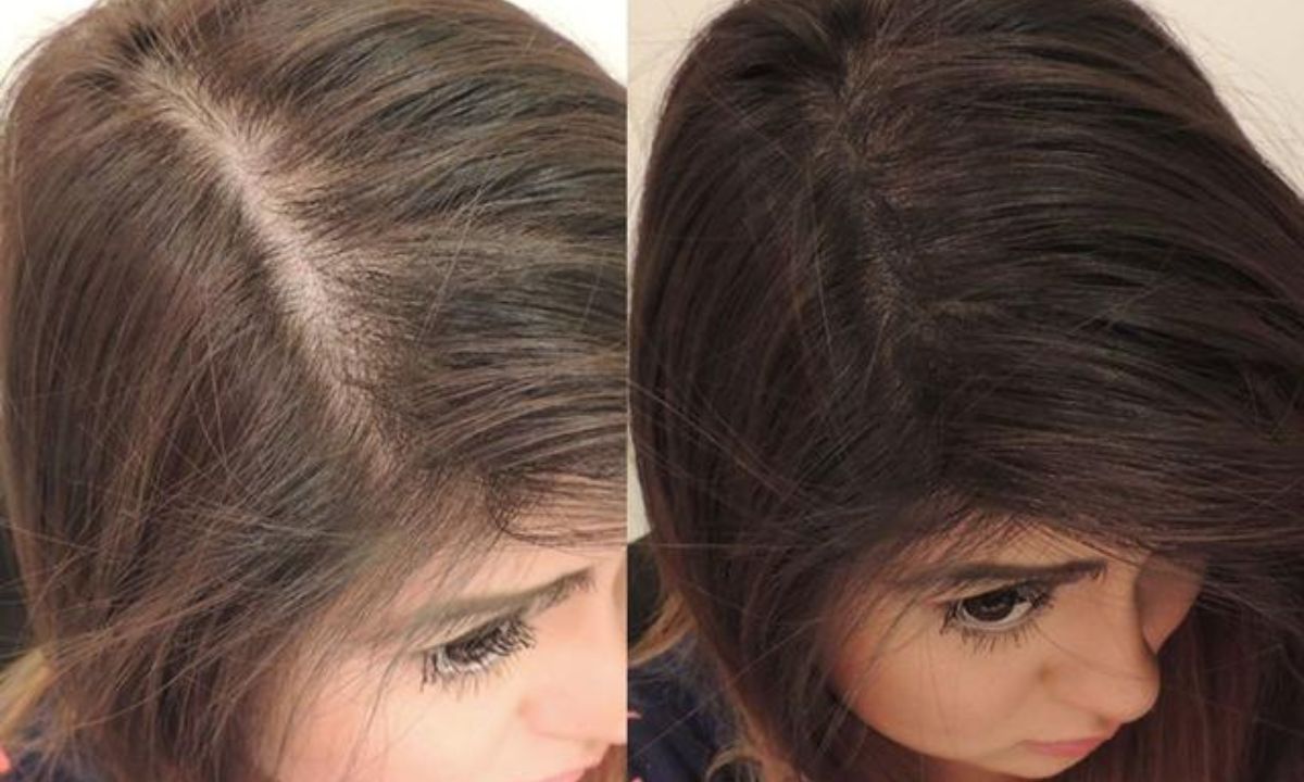 وصفات طبيعية منزلية لملء فراغات الشعر وتكثيفه