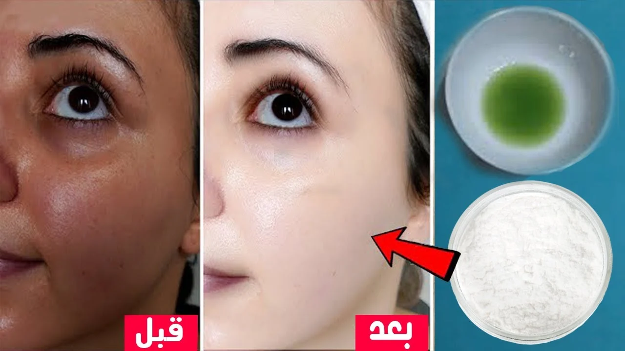 وصفة طبيعية لتفتيح البشرة