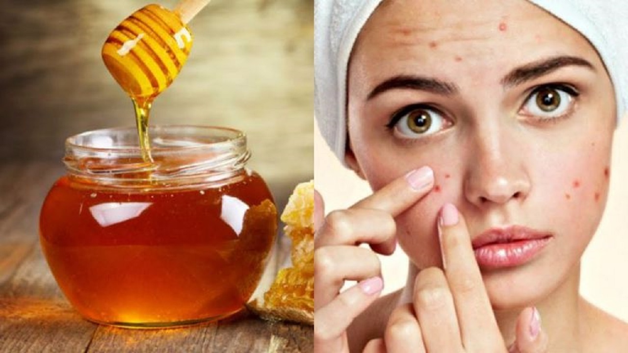 47 125436 benefits honey oily skin recipes 2