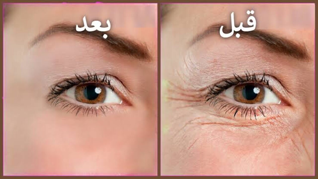 وصفة القهوة للتخلص من التجاعيد