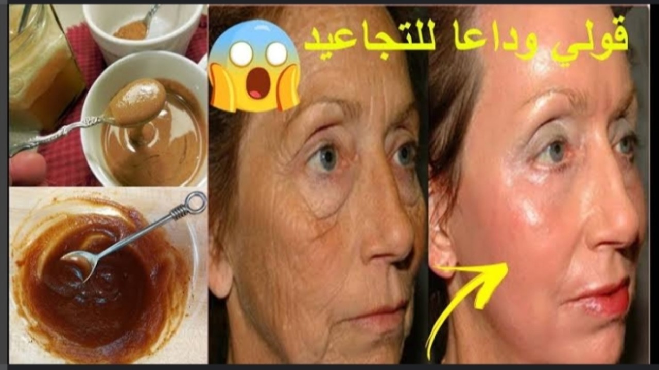 التجاعيد