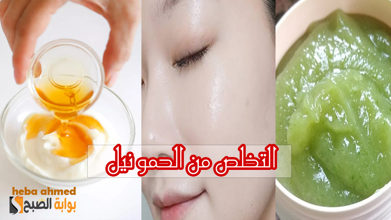 التخلص من الحمو نيل