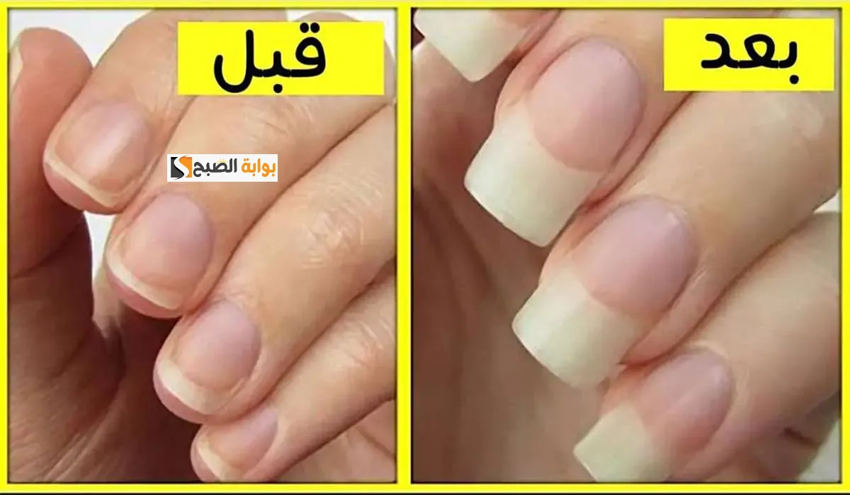 وصفات طبيعية لإطالة الأظافر