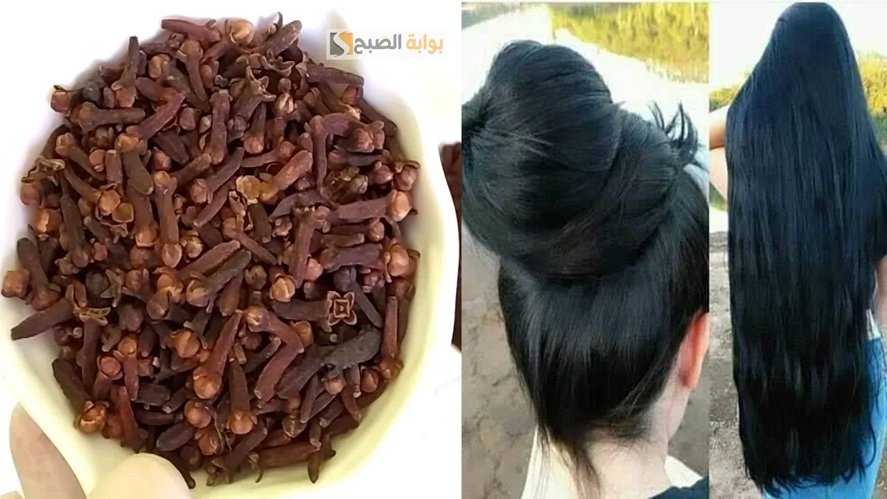  القرنفل لتطويل الشعر