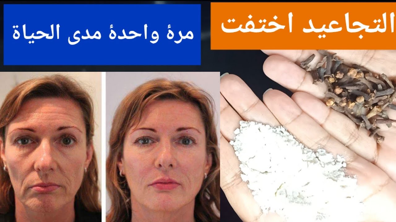 القرنفل والزبادي لتفتيح لون البشرة