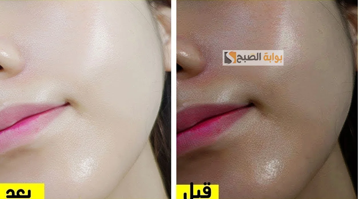 المرة والعسل لعلاج اسمرار البشرة