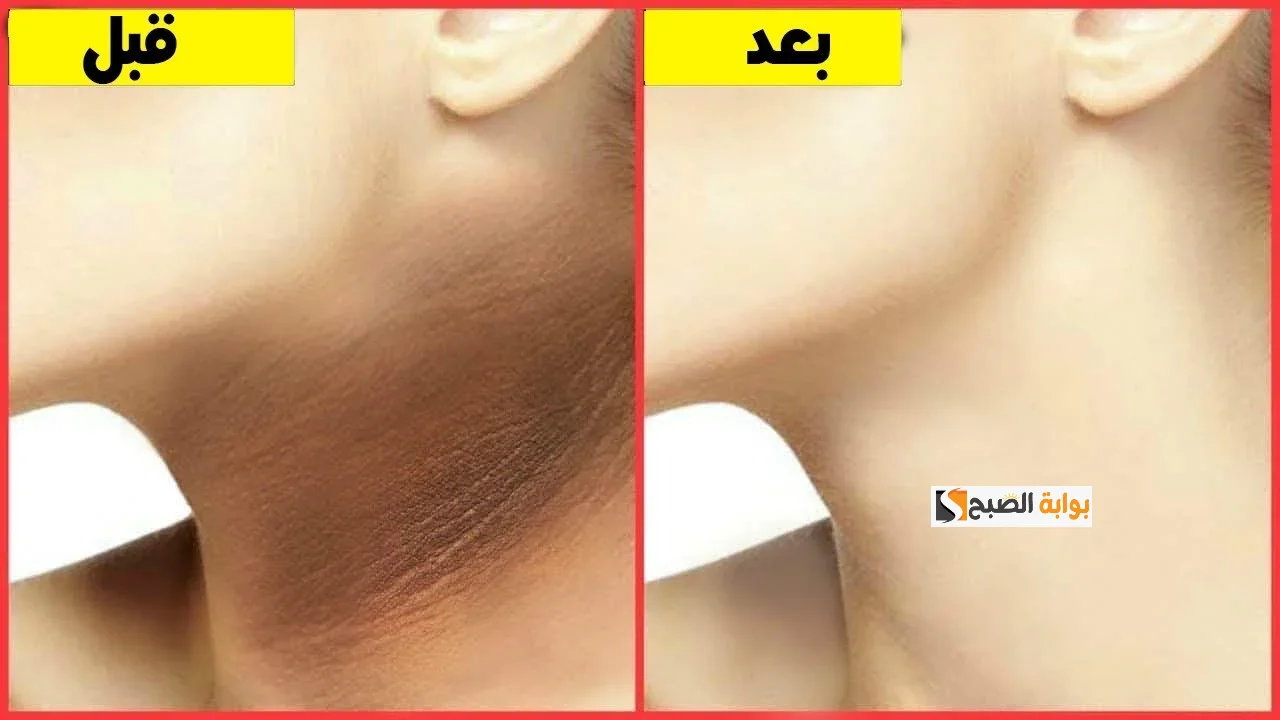 تفتيح منطقة الرقبة