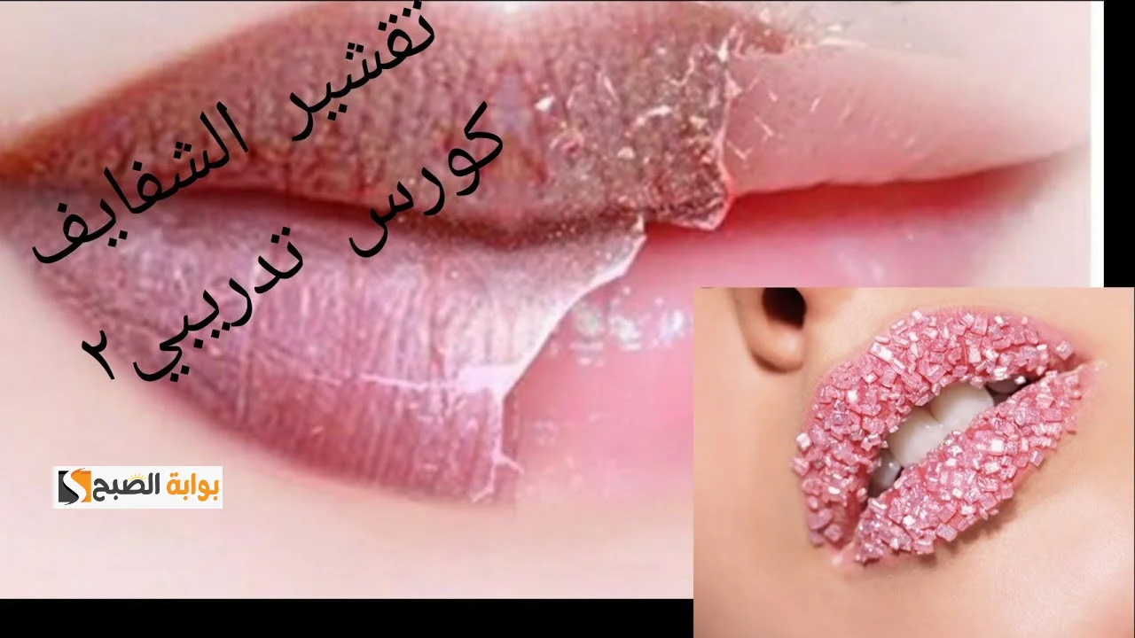 تقشير الشفايف