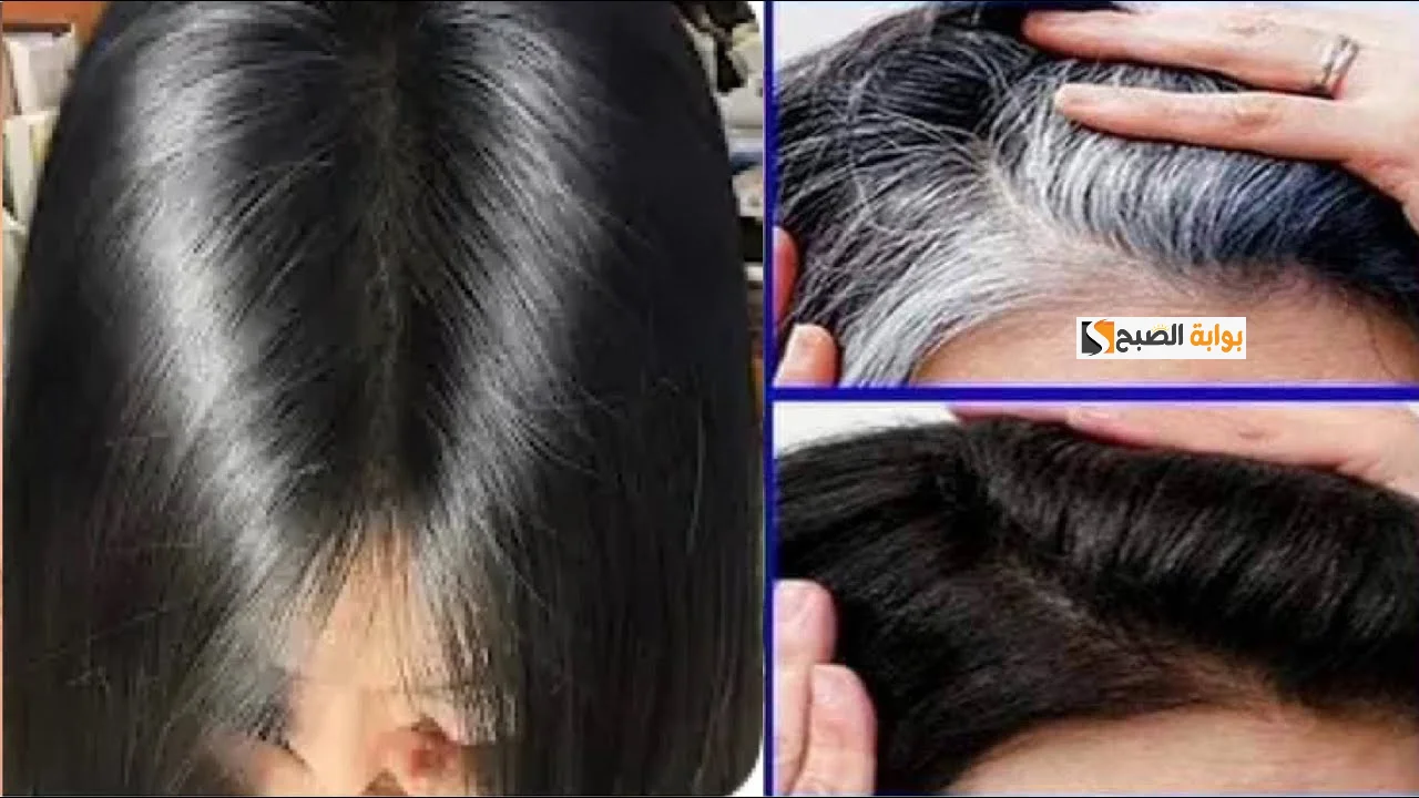 علاج الشيب الأبيض بالموز