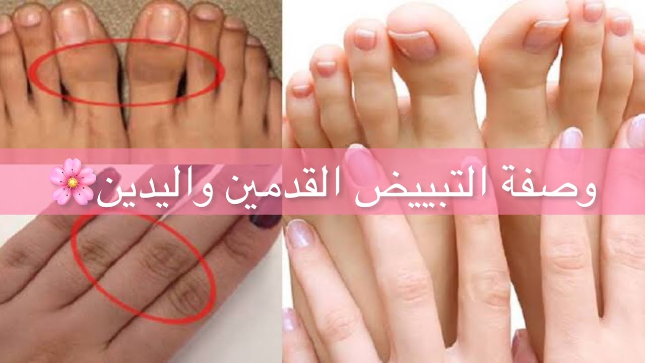 وصفة مغربية لتفتيح اليدين والقدمين