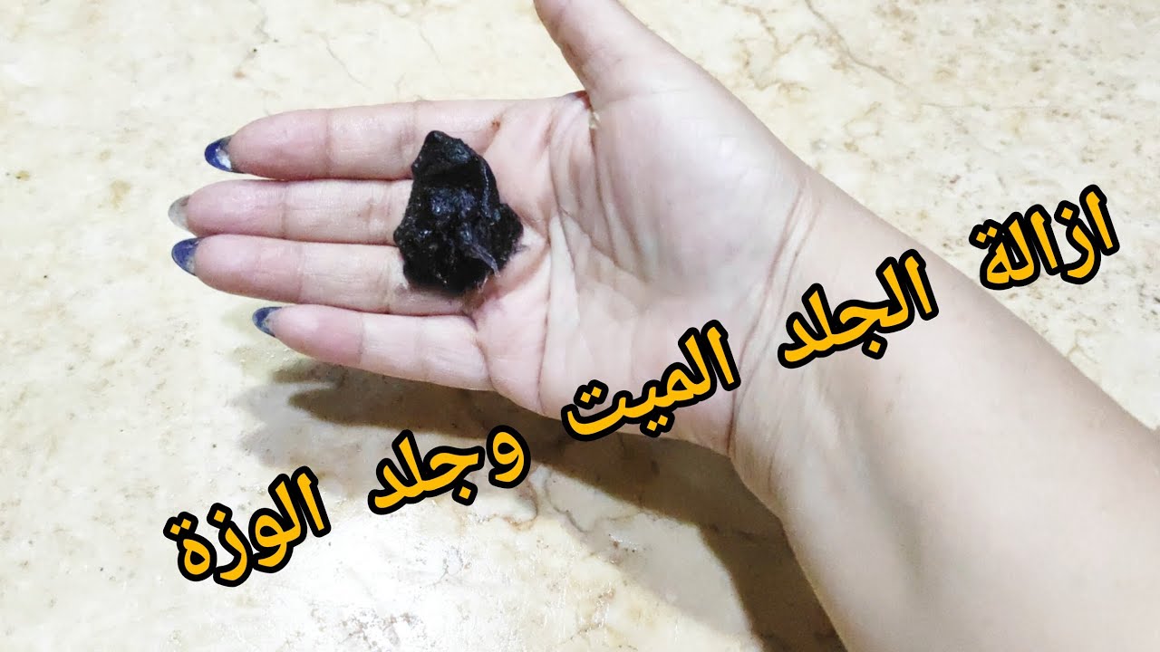 إزالة الجلد الميت