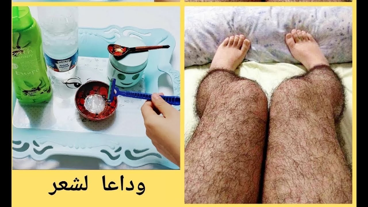 الخل لإزالة الشعر الزائد