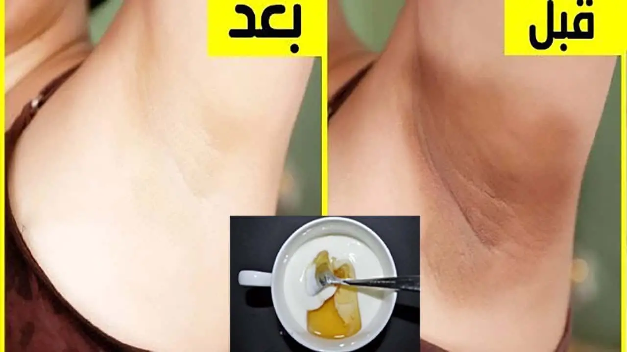 تبيض المناطق الحساسة