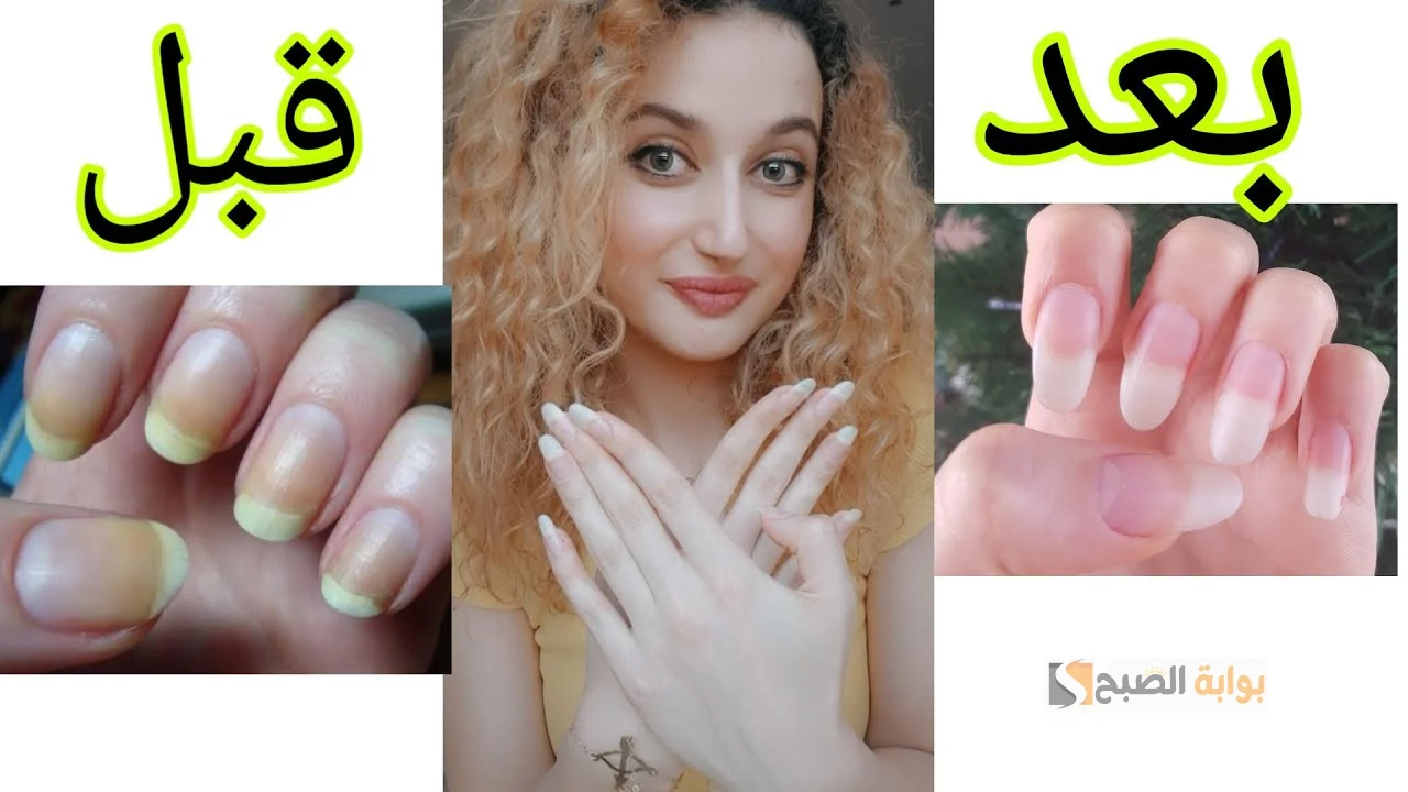 تبييض الأظافر