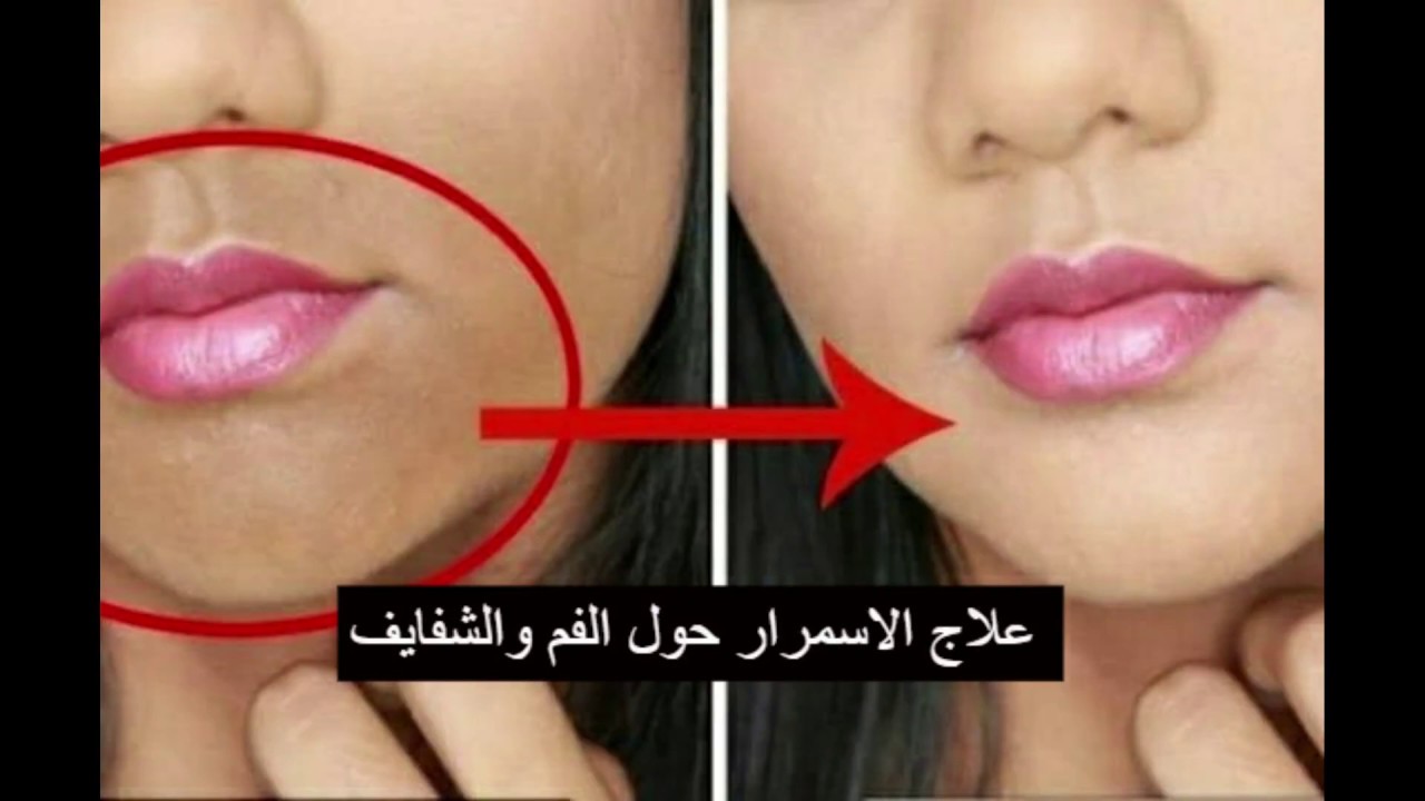 تخلص من الاسمرار حول الفم
