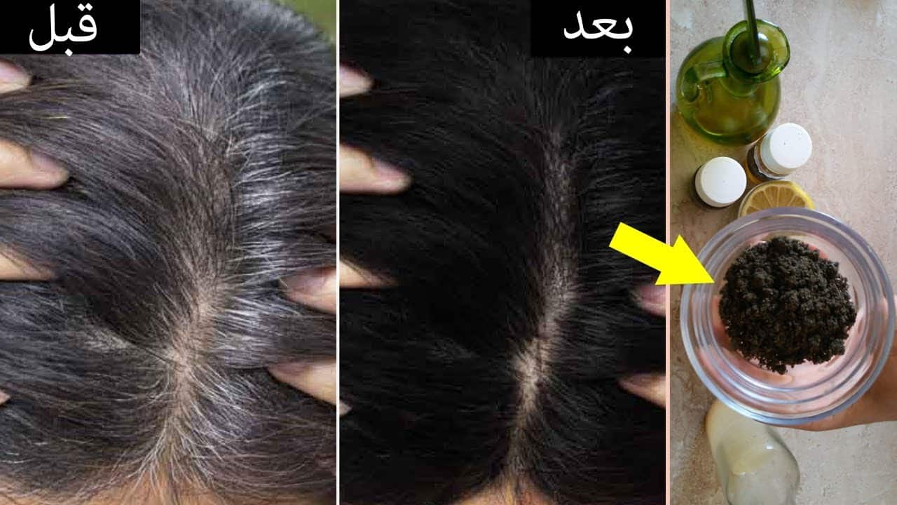 طرق التخلص من الشعر الأبيض