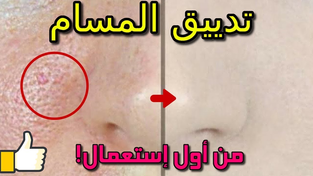 طريقة سد مسام الوجه