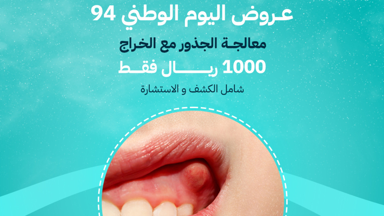 عروض اليوم الوطني الاسنان