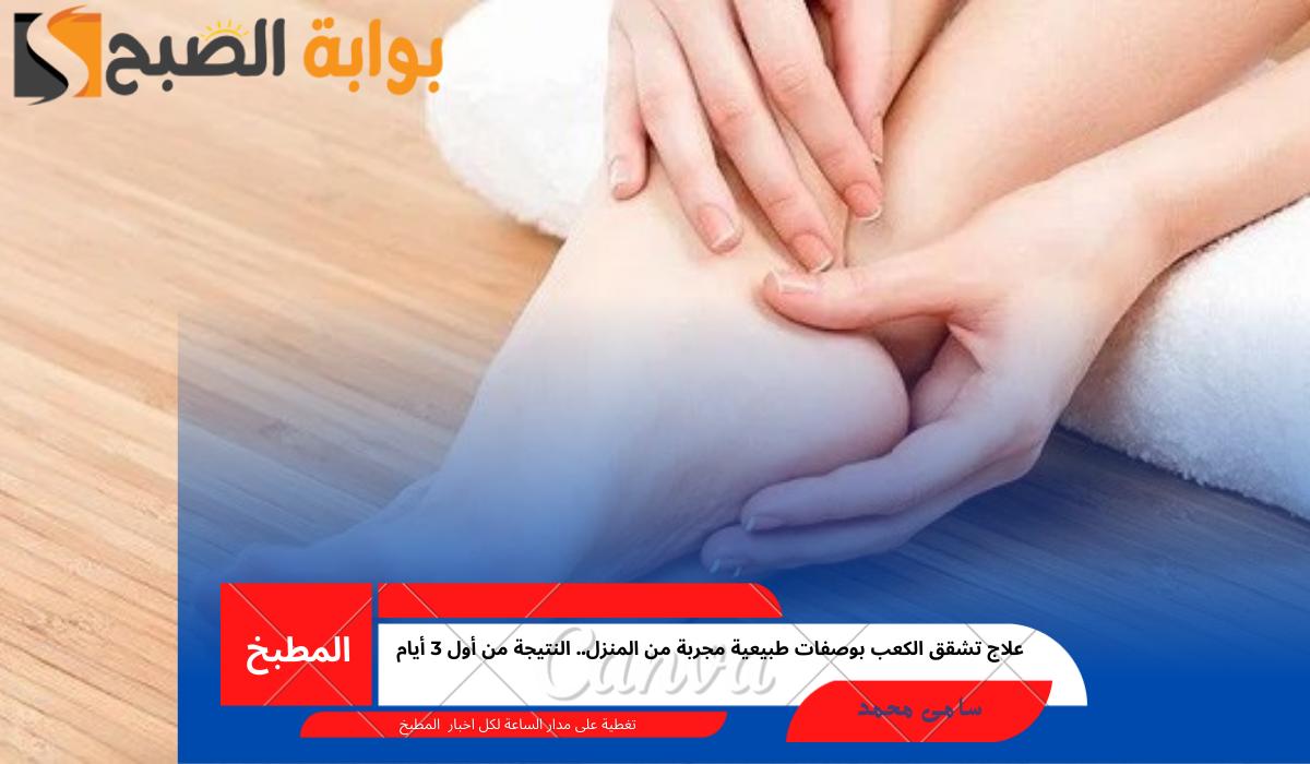 علاج تشقق الكعب