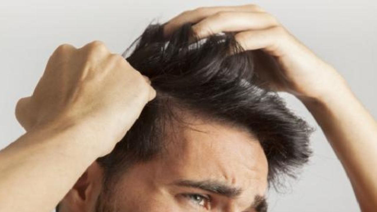 كيفية التخلص من قشرة الرأس
