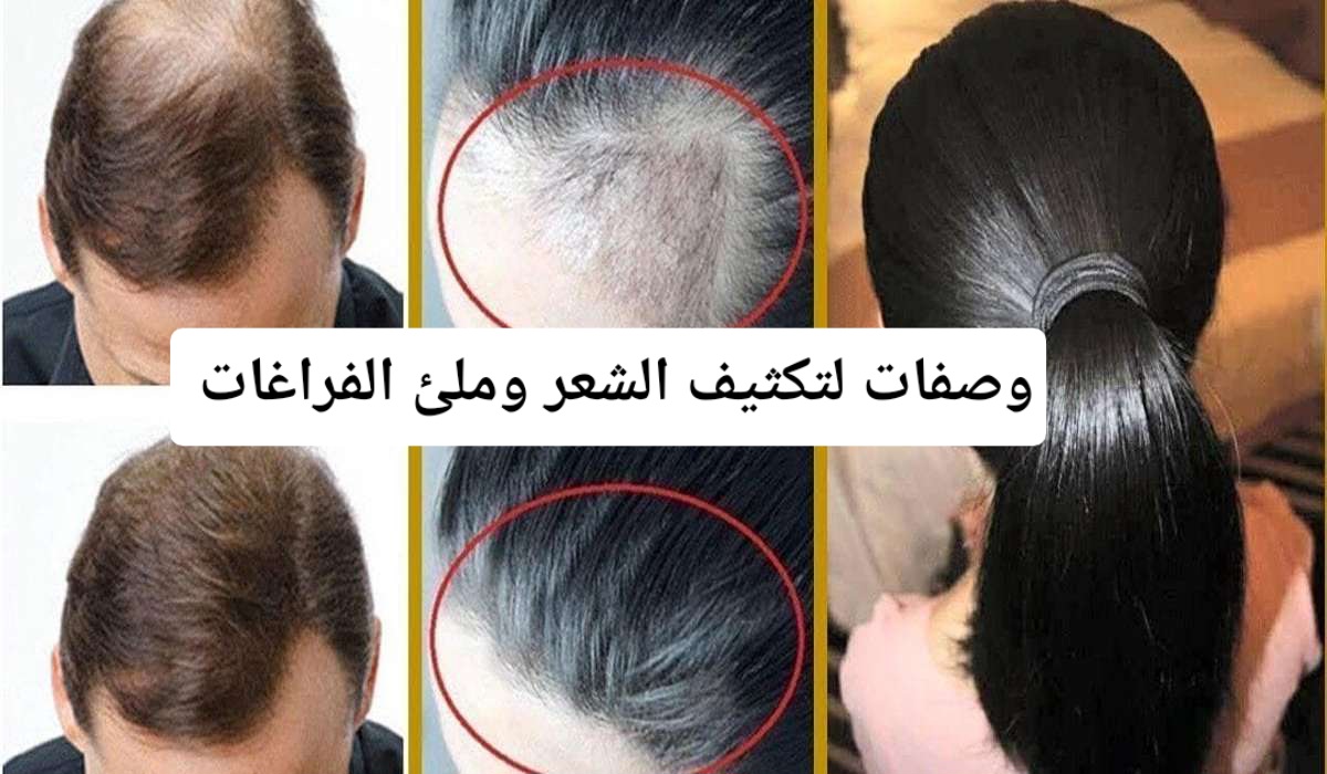 وصفات لتكثيف الشعر وملئ الفراغات