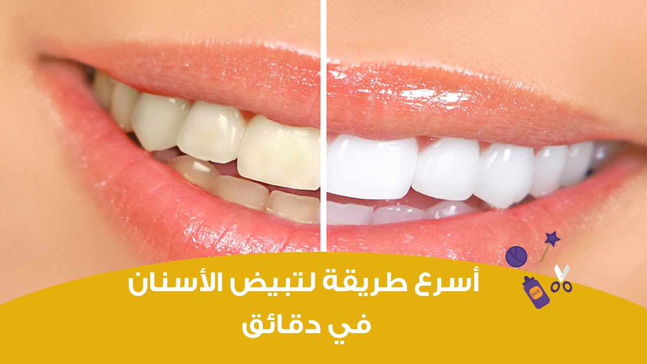 وصفه تبييض الاسنان بالفحم
