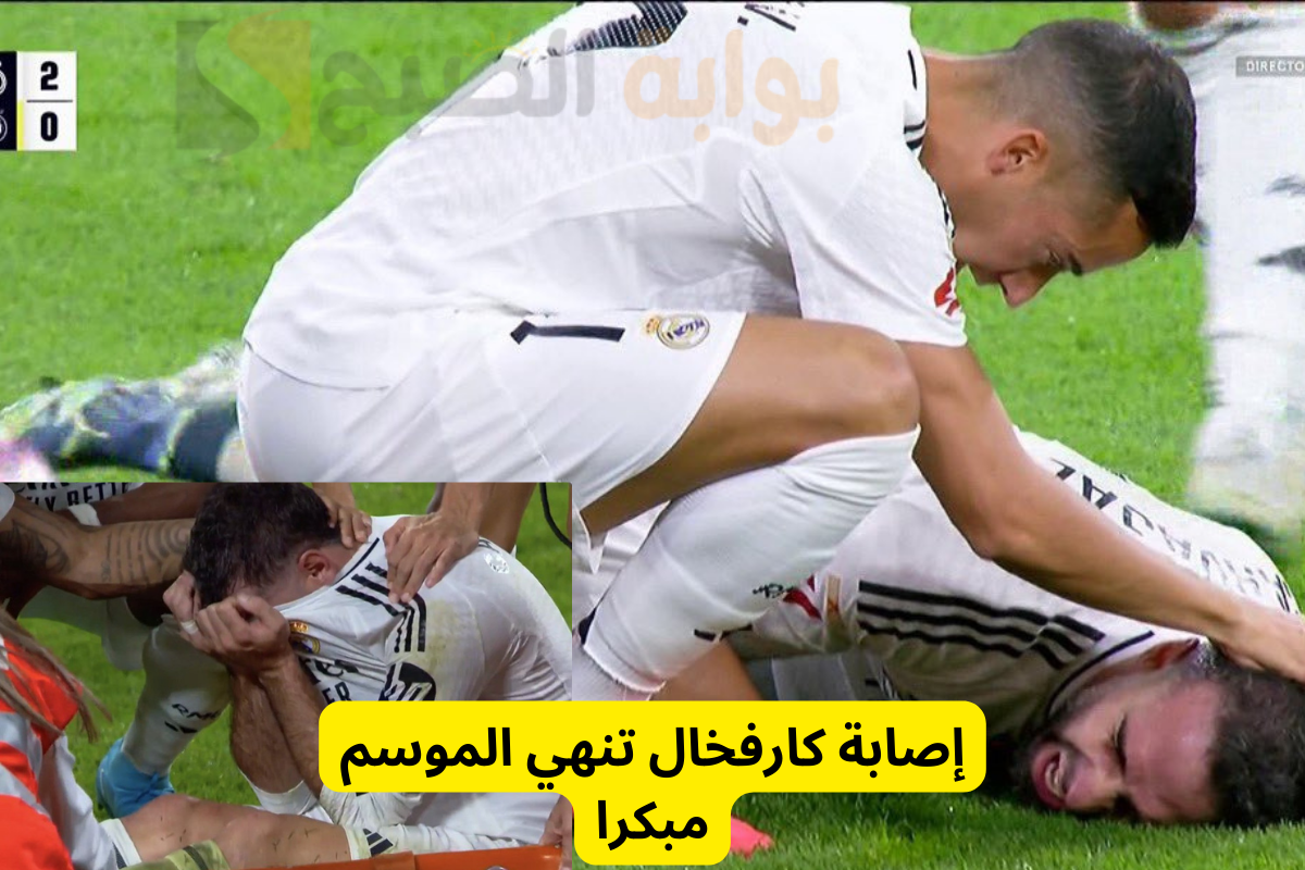 إصابة كارفخال