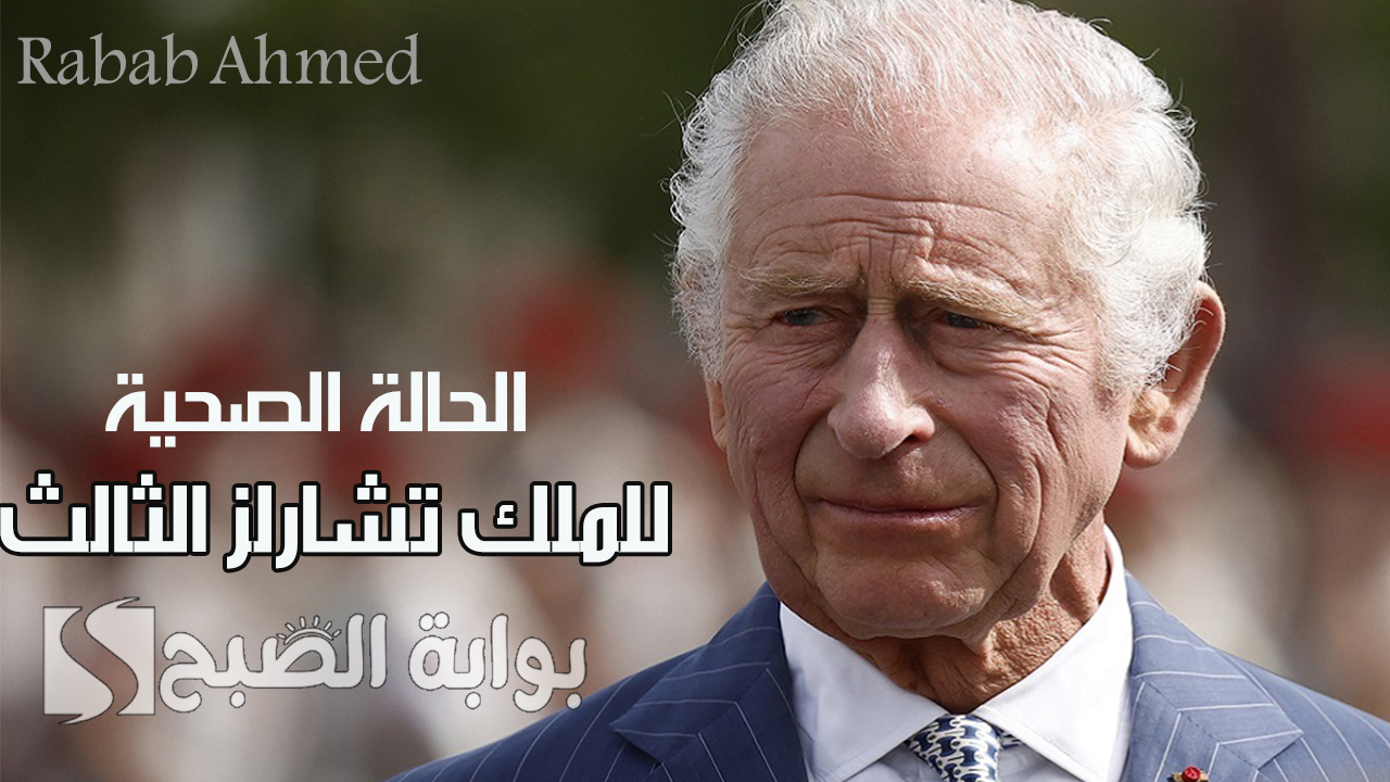 الحالة الصحية للملك تشارلز