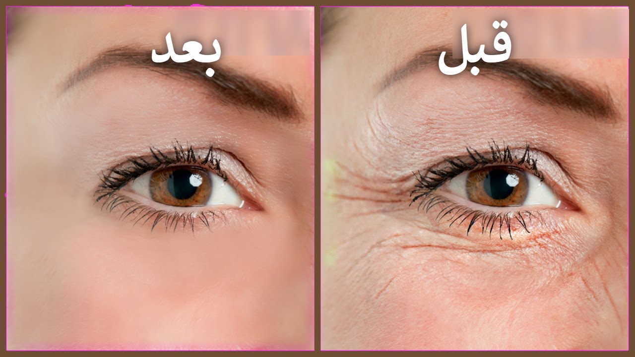 تجاعيد البشرة