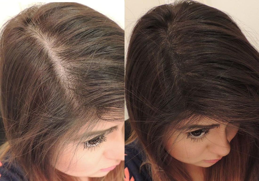 خلطات طبيعية لتغذية الشعر وملء الفراغات