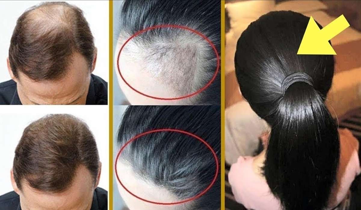وصفات لتكثيف الشعر