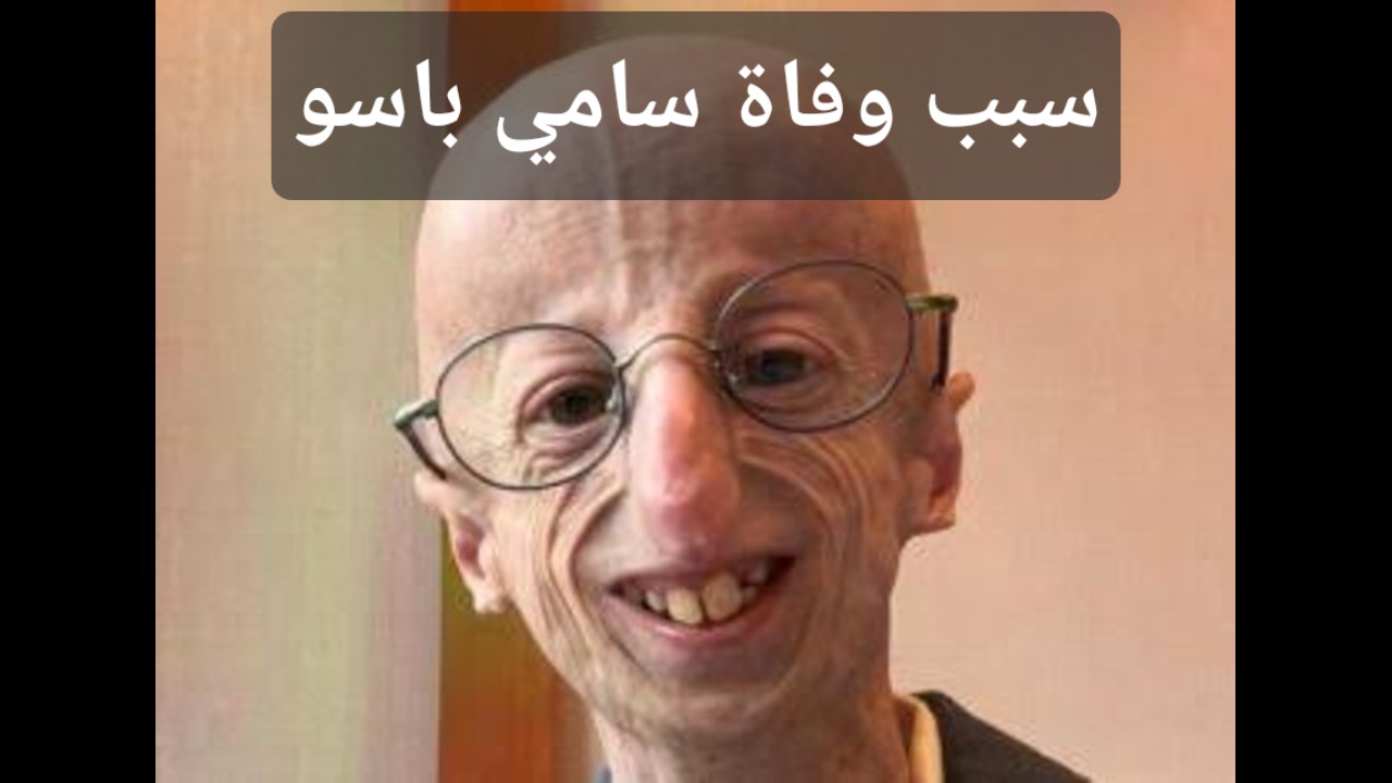 وفاة سامي باسو