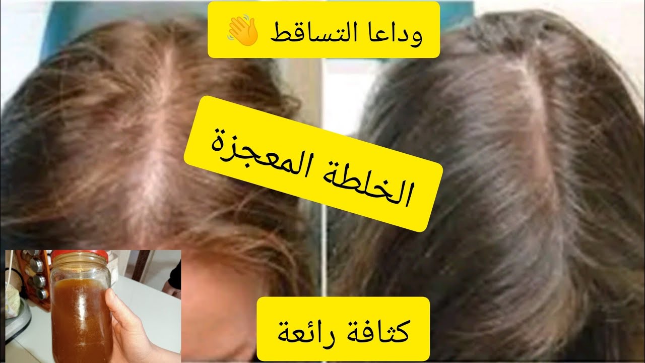 الروزماري وقشر الرمان للشعر