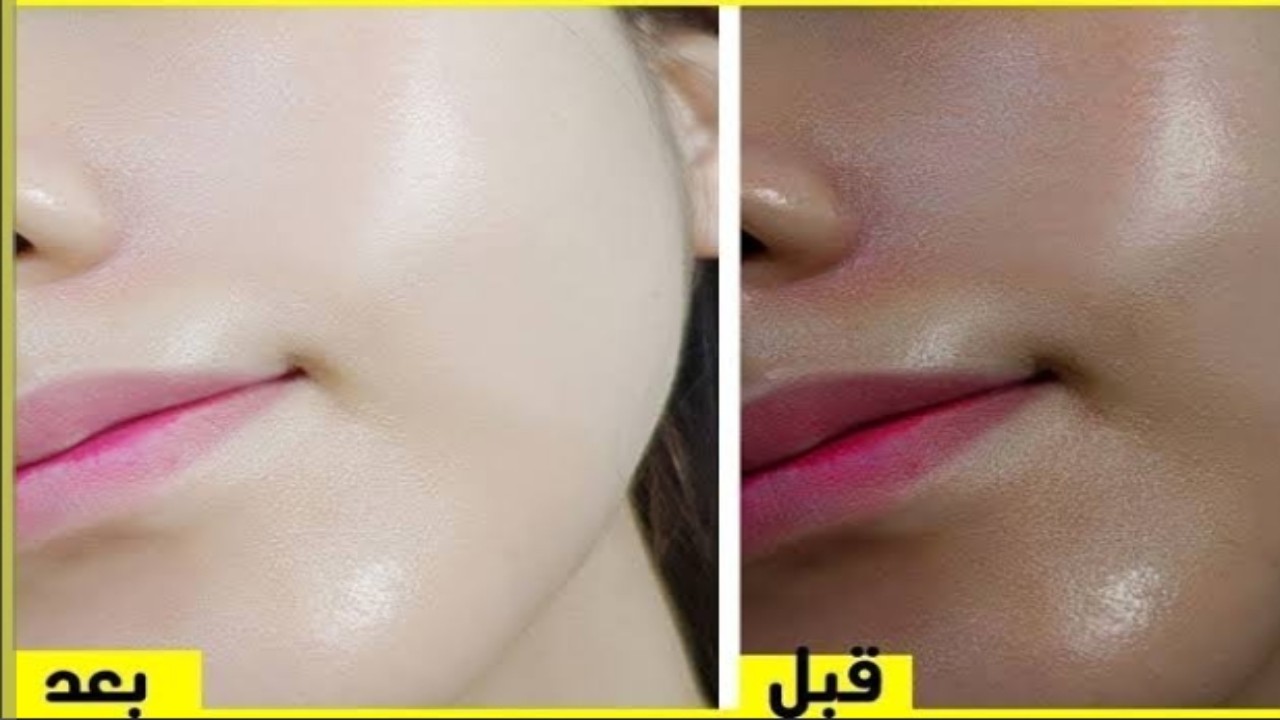 تفتيح البشره