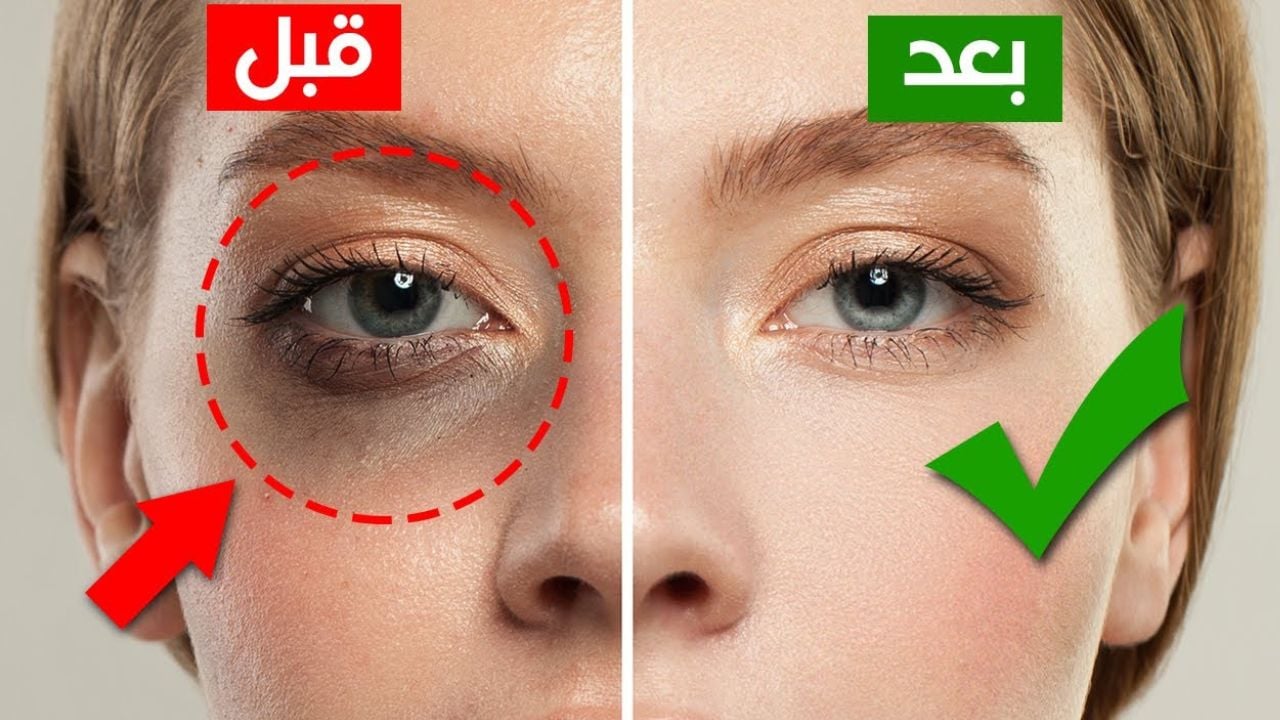 قناع العسل للتخلص من الهالات السوداء