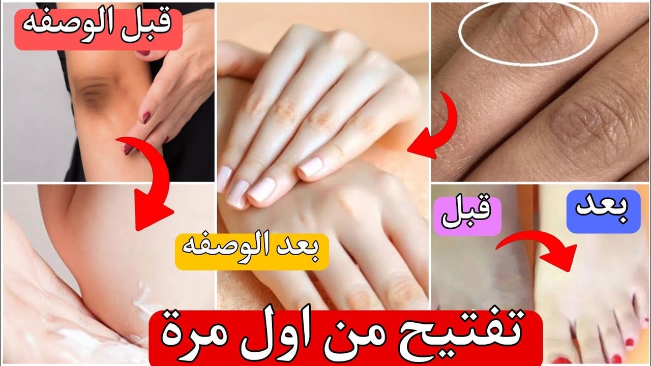 وصفة زيت الزيتون والليمون لتفتيح اليدين