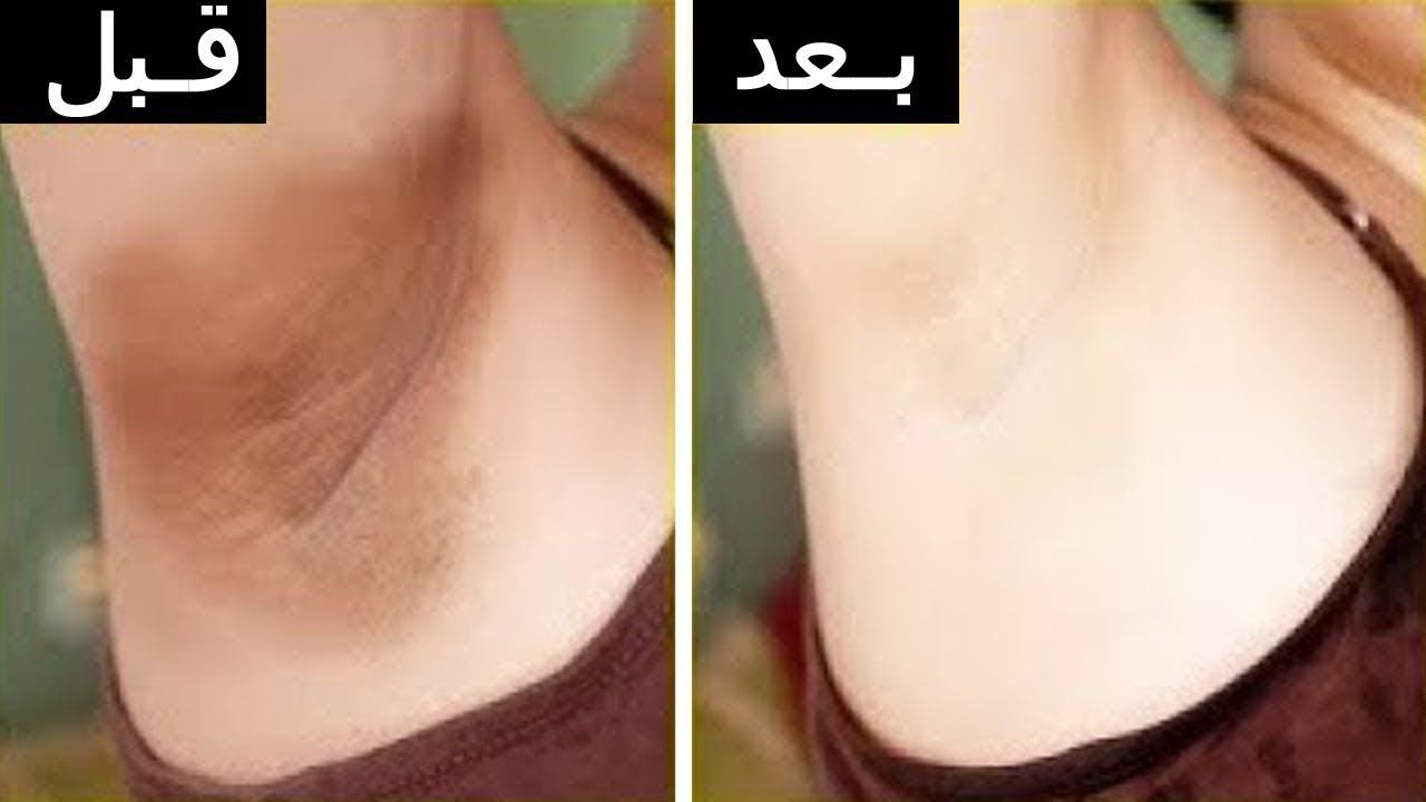 تبييض الجسم1