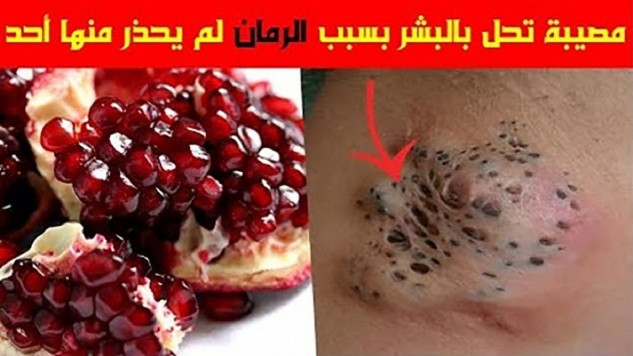 خطورة الرمان