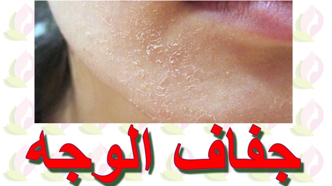 وصفات طبيعية لترطيب الوجه والجسم