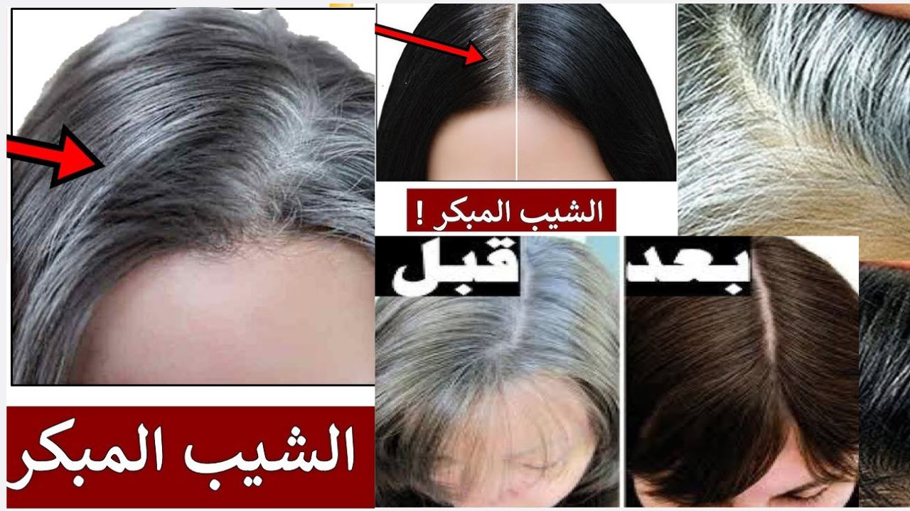 وصفة للتخلص من الشيب المبكر