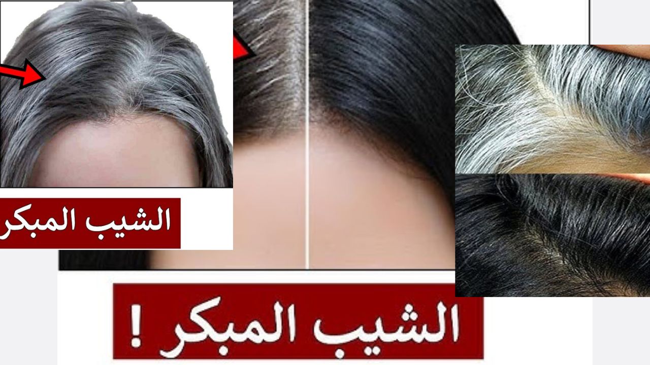 وصفة للتخلص من الشيب