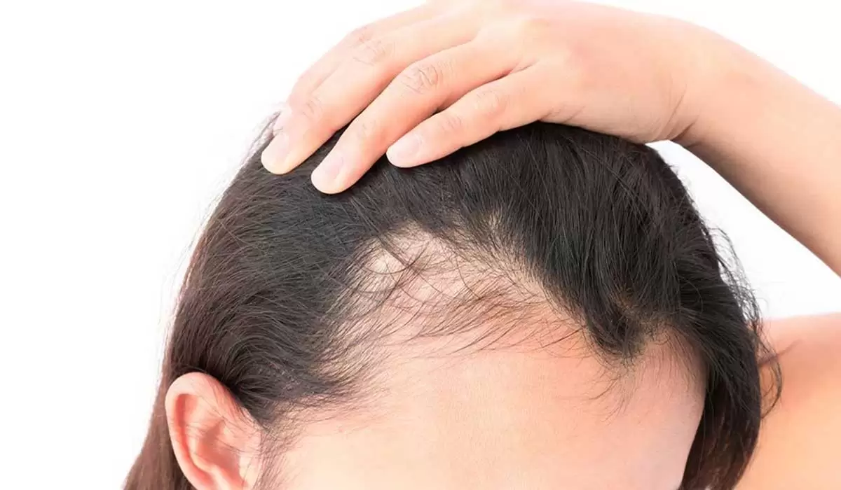 تكثيف ونعومة في وقت سريع.. ماسك زيت الخروع لعلاج الشعر الخفيف وتعزيز نموه