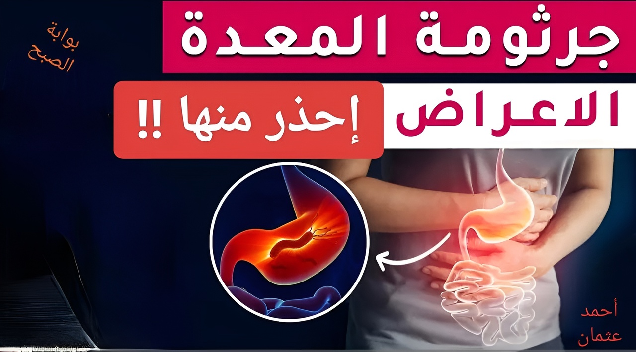 IMG ٢٠٢٥٠٢٢٢ ٢٢٠٠١٤