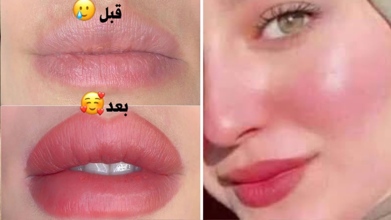 توريد الشفايف