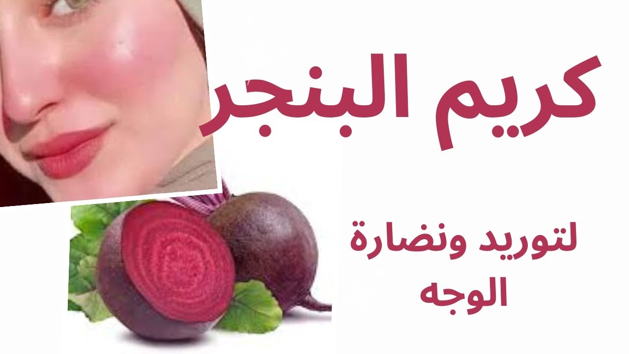 توريد الخدود بالبنجر